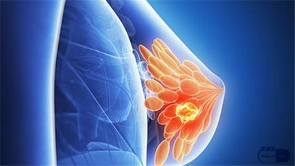 1684480104460576.jpeg 乳腺结节.jpeg